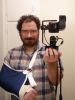 09/18 - 01 - Fractured Elbow by Alan Bryant