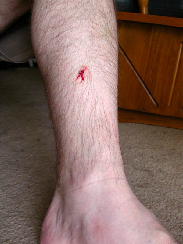 08/13 - 02 Cut Leg