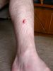 08/13 - 02 Cut Leg by Alan Bryant