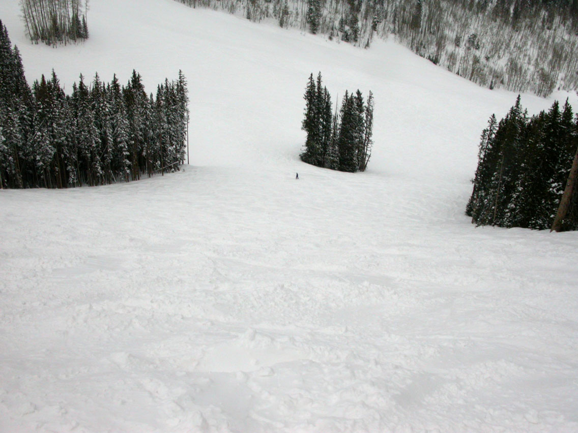 05 - View Down Cataract