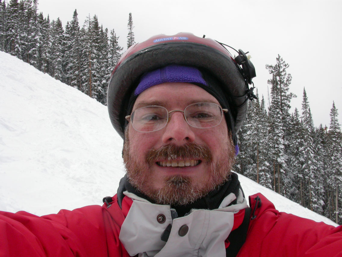 06 - Alan On Cataract