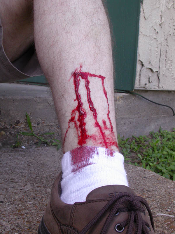 08/13 - 01 Cut Leg