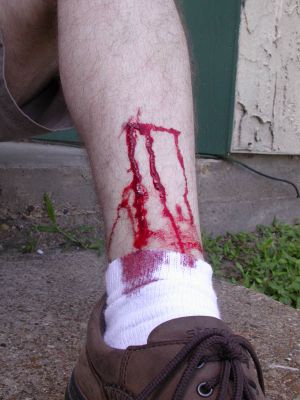 08/13 - 01 Cut Leg